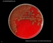 pneumococci on blood agar